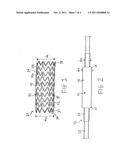 COATED STENT diagram and image