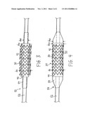 COATED STENT diagram and image