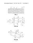 ROTATABLE SUPPORT ELEMENTS FOR STENTS diagram and image