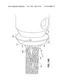 ROTATABLE SUPPORT ELEMENTS FOR STENTS diagram and image