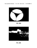 ROTATABLE SUPPORT ELEMENTS FOR STENTS diagram and image