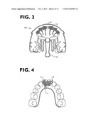 Osteogenetic-Pneumopedic Appliance, System, and Method. diagram and image