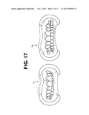 Osteogenetic-Pneumopedic Appliance, System, and Method. diagram and image