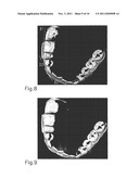 SURFACE MAPPING AND GENERATING DEVICES AND METHODS FOR SURFACE MAPPING AND     SURFACE GENERATION diagram and image