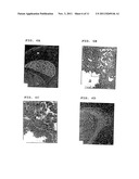 Expression Vectors and Cell Lines Expressing Vascular Endothelial Growth     Factor D, and Method of Treating Melanomas diagram and image