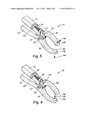 Pressure-Applying device diagram and image