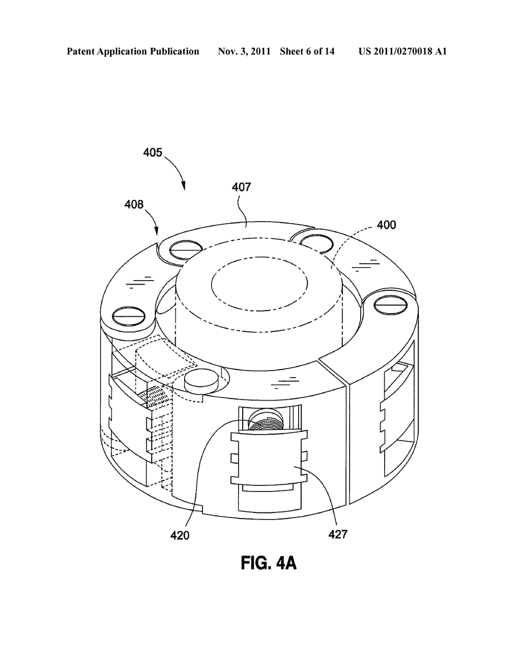 SELF-ADJUSTING MECHANICAL GASTRIC BAND - diagram, schematic, and image 07