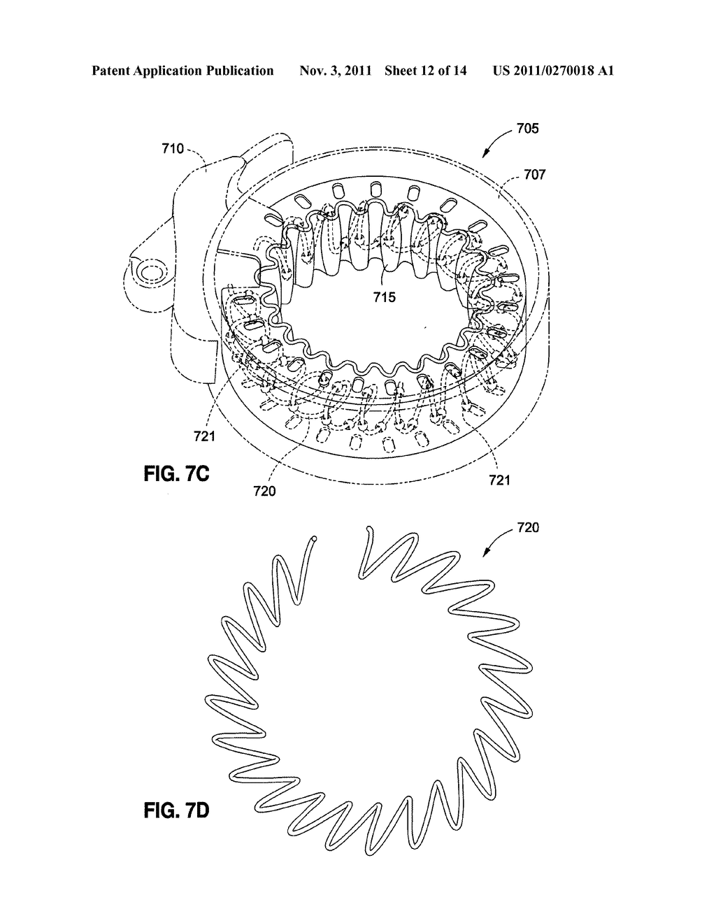 SELF-ADJUSTING MECHANICAL GASTRIC BAND - diagram, schematic, and image 13