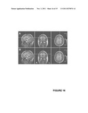 Methods for physiological monitoring, training, exercise and regulation diagram and image