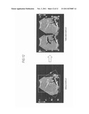 METHOD AND APPARATUS FOR ULTRASONIC DIAGNOSIS diagram and image