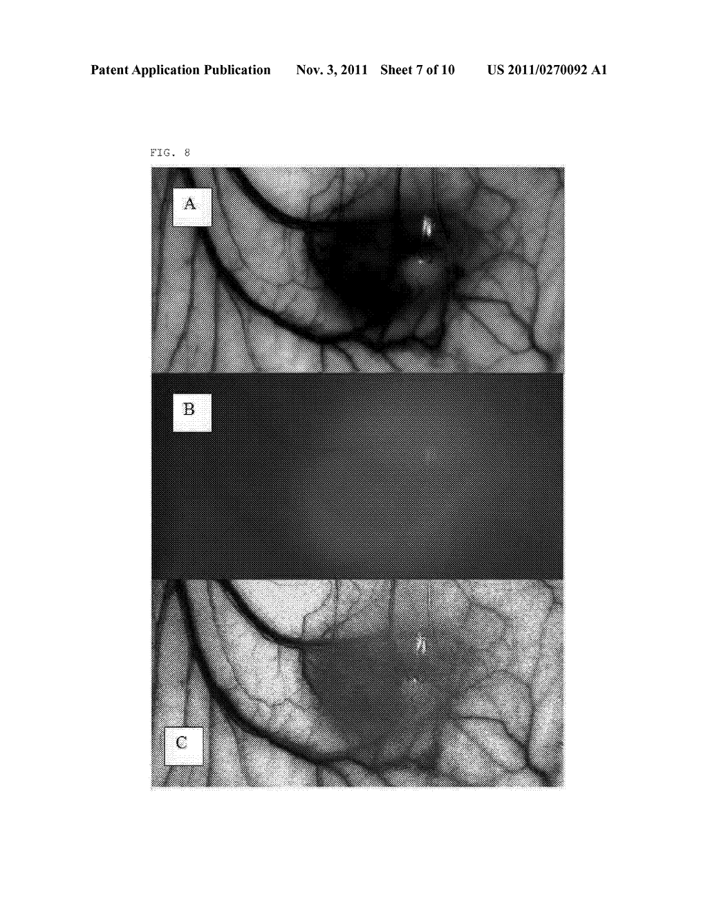 COMBINED APPARATUS FOR DETECTION OF MULTISPECTRAL OPTICAL IMAGE EMITTED     FROM LIVING BODY AND FOR LIGHT THERAPY - diagram, schematic, and image 08