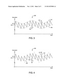 NONINVASIVE HYPOVOLEMIA MONITOR diagram and image