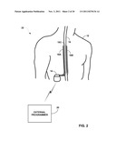 DETECTING POSTURE SENSOR SIGNAL SHIFT OR DRIFT IN MEDICAL DEVICES diagram and image