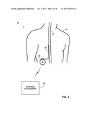 DETECTING POSTURE SENSOR SIGNAL SHIFT OR DRIFT IN MEDICAL DEVICES diagram and image