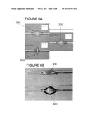 REPERFUSION BALLOON INFLATION DEVICE diagram and image