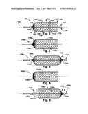 METHOD AND APPARATUS FOR INCREASING BLOOD FLOW THROUGH AN OBSTRUCTED BLOOD     VESSEL diagram and image