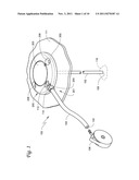 BODY PORTAL ANCHORS AND SYSTEMS diagram and image