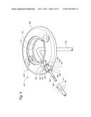 BODY PORTAL ANCHORS AND SYSTEMS diagram and image