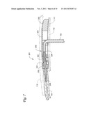 BODY PORTAL ANCHORS AND SYSTEMS diagram and image