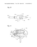 BODY PORTAL ANCHORS AND SYSTEMS diagram and image