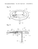 BODY PORTAL ANCHORS AND SYSTEMS diagram and image