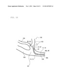 CATHETER diagram and image