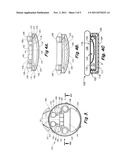 Implantable Infusion Device With Multiple Controllable Fluid Outlets diagram and image