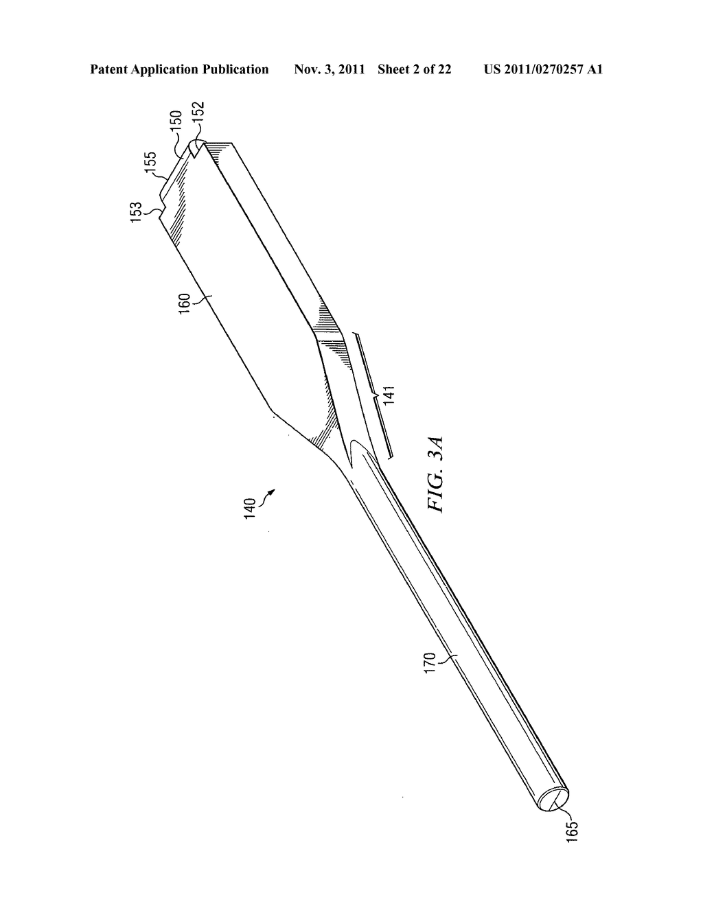 Spondylolisthesis correction apparatus and method - diagram, schematic, and image 03