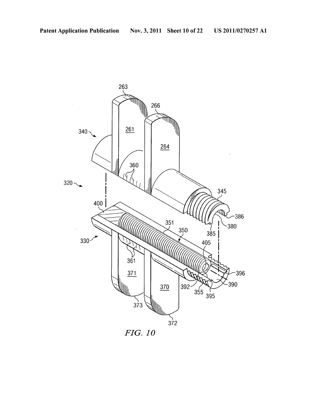 Spondylolisthesis correction apparatus and method - diagram, schematic, and image 11