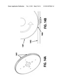 ORTHOPEDIC CAST REMOVER diagram and image