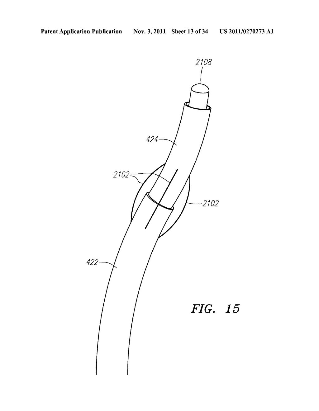 SYSTEMS AND METHODS FOR PERFORMING MINIMALLY INVASIVE SURGICAL OPERATIONS - diagram, schematic, and image 14