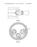 ATHERECTOMY DEVICES AND METHODS diagram and image