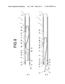 MEDICAL KNIFE diagram and image