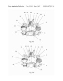 Spinal Fixation Device And Technique For Expansion Of The Spinal Canal diagram and image