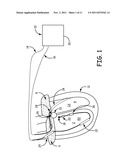 THERAPY USING PERTURBATION AND EFFECT OF PHYSIOLOGICAL SYSTEMS diagram and image