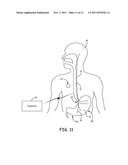 THERAPY USING PERTURBATION AND EFFECT OF PHYSIOLOGICAL SYSTEMS diagram and image