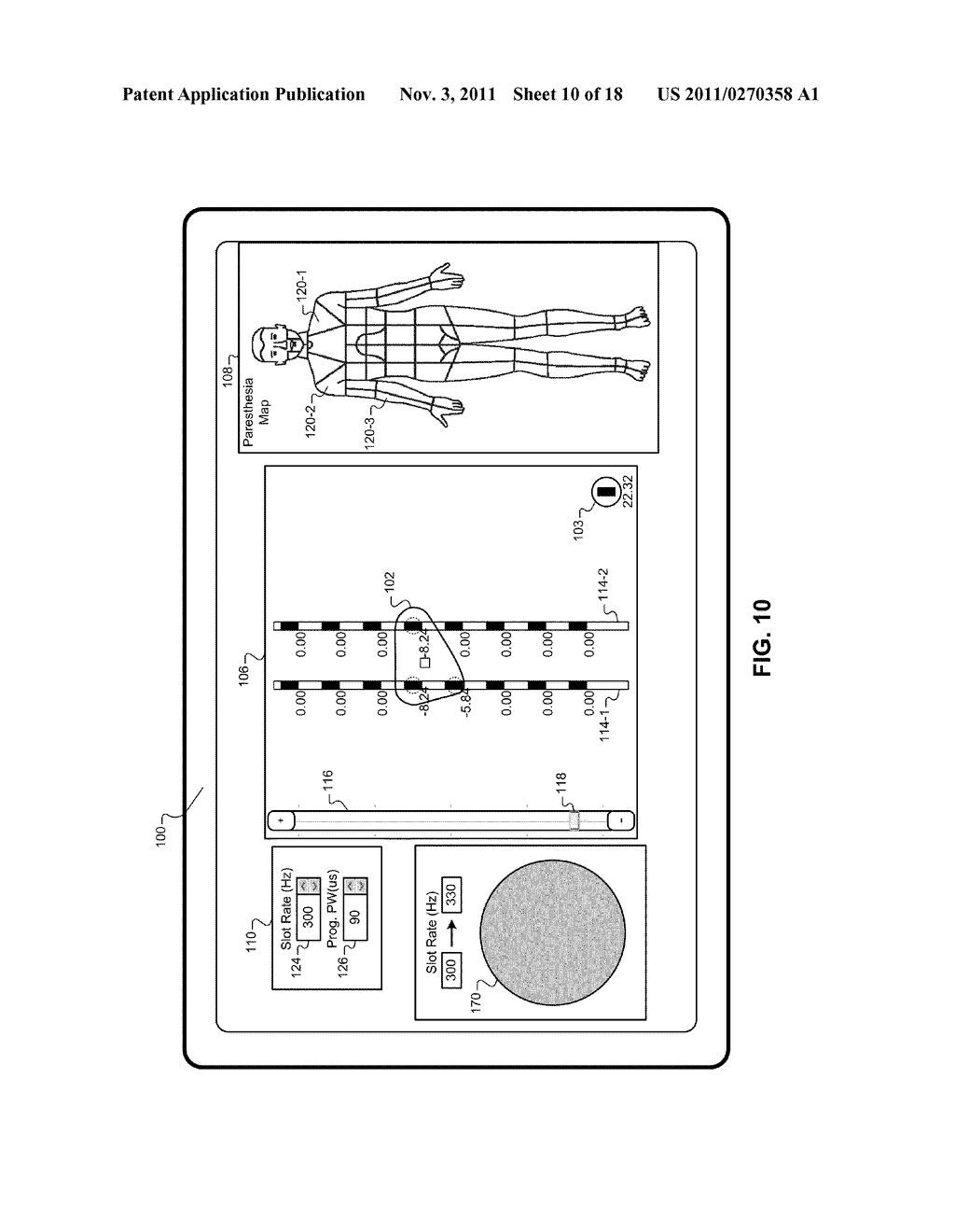 IMPLANTABLE MEDICAL DEVICE PROGRAMMING USING GESTURE-BASED CONTROL - diagram, schematic, and image 11