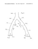 CLOSURE DEVICE diagram and image