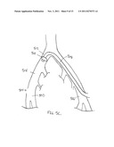 CLOSURE DEVICE diagram and image