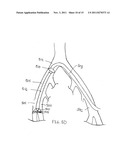 CLOSURE DEVICE diagram and image