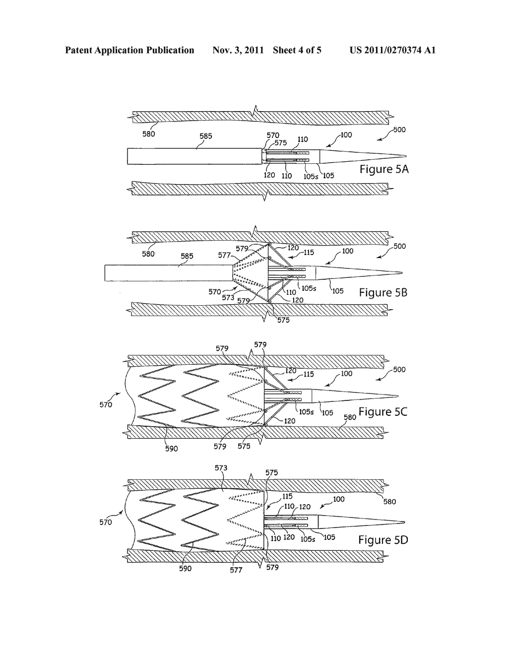 SYSTEM AND METHOD FOR DEPLOYING AND POSITIONING AN ENDOVASCULAR DEVICE - diagram, schematic, and image 05