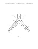 INTRODUCER FOR AN ILIAC SIDE BRANCH DEVICE diagram and image