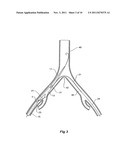 INTRODUCER FOR AN ILIAC SIDE BRANCH DEVICE diagram and image