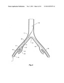 INTRODUCER FOR AN ILIAC SIDE BRANCH DEVICE diagram and image