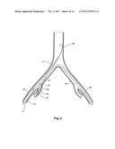 INTRODUCER FOR AN ILIAC SIDE BRANCH DEVICE diagram and image