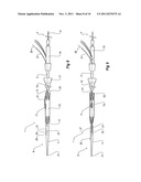 INTRODUCER FOR AN ILIAC SIDE BRANCH DEVICE diagram and image