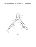 INTRODUCER FOR A SIDE BRANCH DEVICE diagram and image