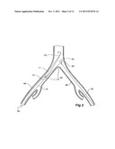 INTRODUCER FOR A SIDE BRANCH DEVICE diagram and image