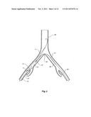 INTRODUCER FOR A SIDE BRANCH DEVICE diagram and image