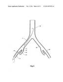 INTRODUCER FOR A SIDE BRANCH DEVICE diagram and image